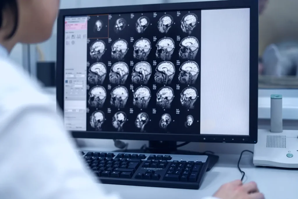 A doctor examining brain scan images on a computer screen, representing brain injury and serious medical negligence claims.